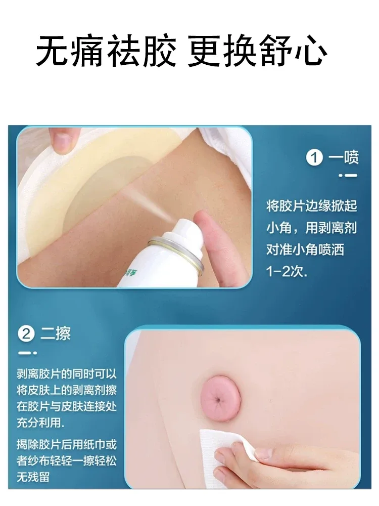 造口黏胶祛除喷剂剥离剂60ml喷剂造口护理造口底盘除胶剂