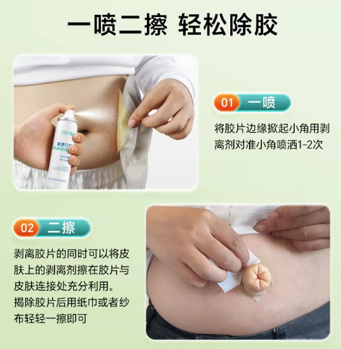 Zaodele stoma glue remover medical glue remover stripper stoma skin care product